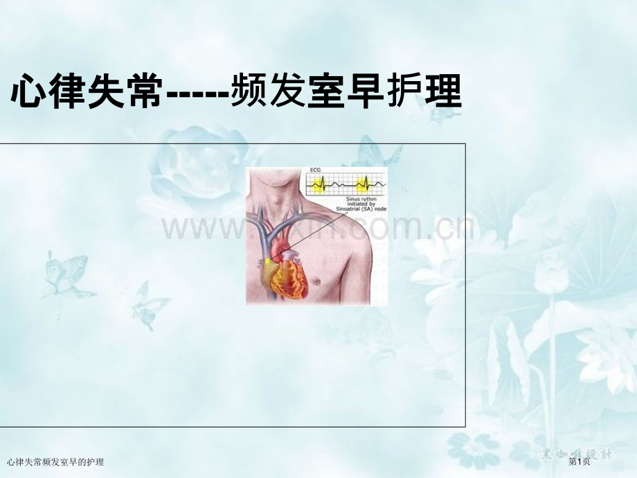 心律失常频发室早的护理专家讲座.pptx_第1页