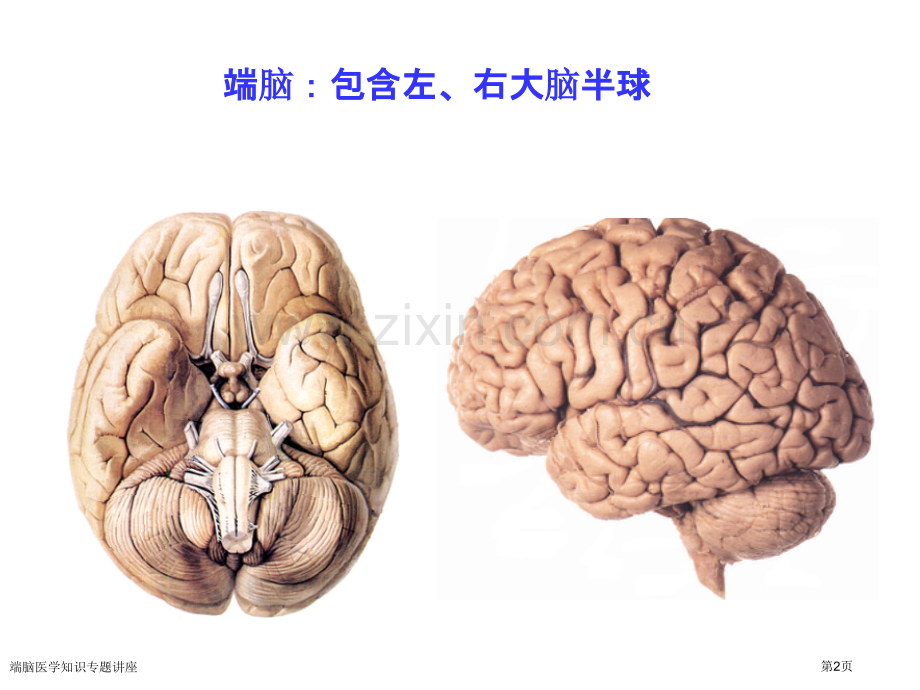 端脑医学知识专题讲座专家讲座.pptx_第2页