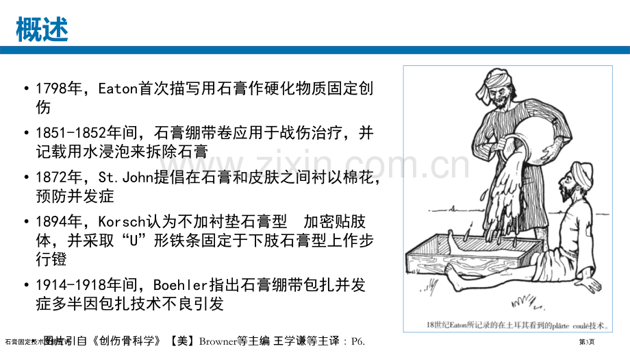 石膏固定技术专题宣讲.pptx_第3页