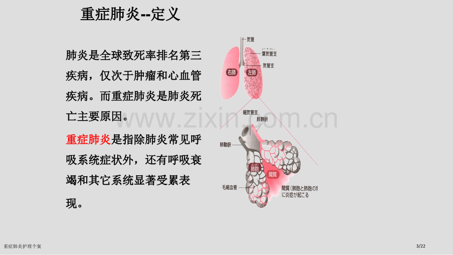 重症肺炎护理个案.pptx_第3页