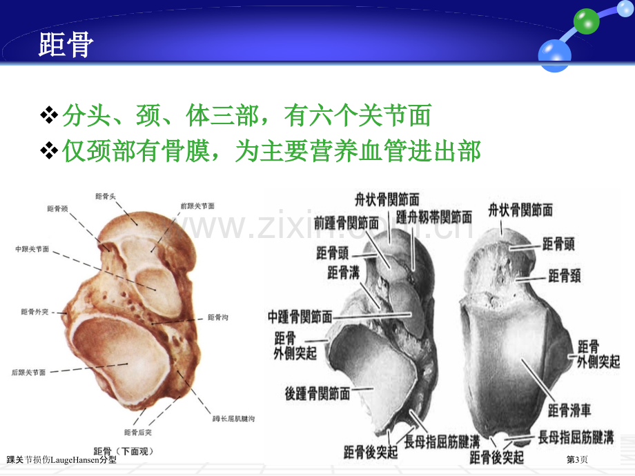 踝关节损伤LaugeHansen分型.pptx_第3页