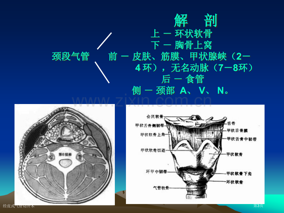 经皮式气管切开术专家讲座.pptx_第3页