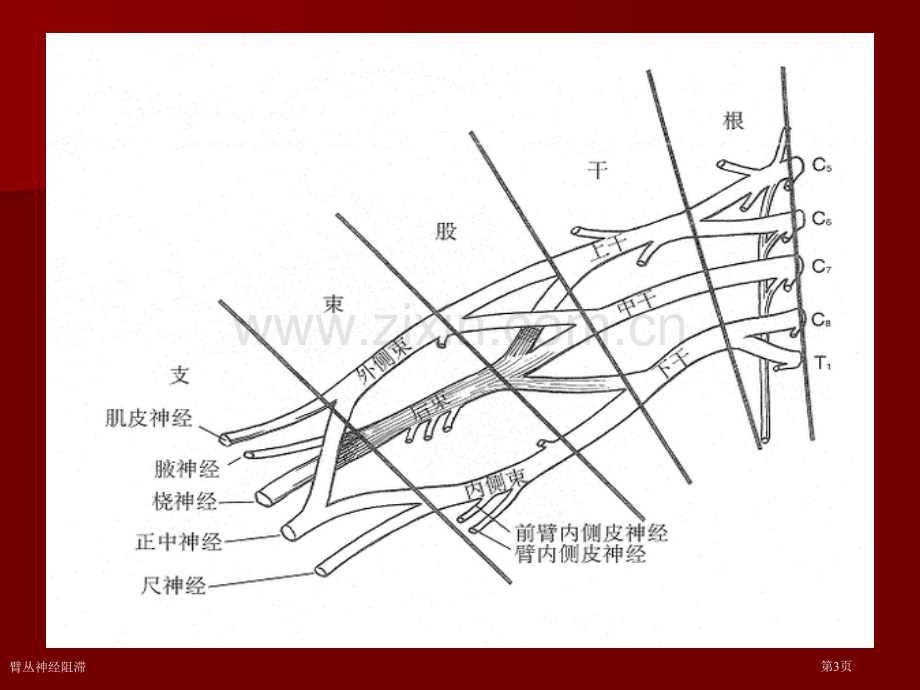 臂丛神经阻滞专家讲座.pptx_第3页