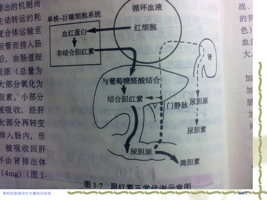 黄疸的鉴别诊疗专题知识宣讲.pptx_第3页