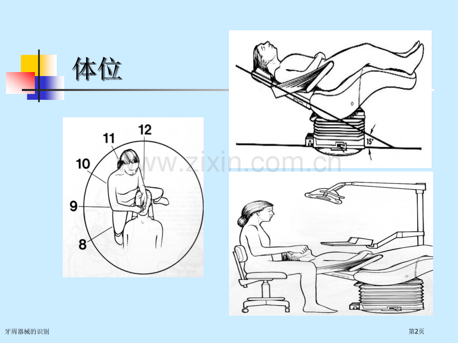 牙周器械的识别.pptx_第2页