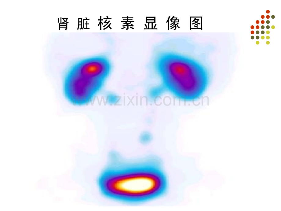 核医学肾显像和功能测定专家讲座.pptx_第3页