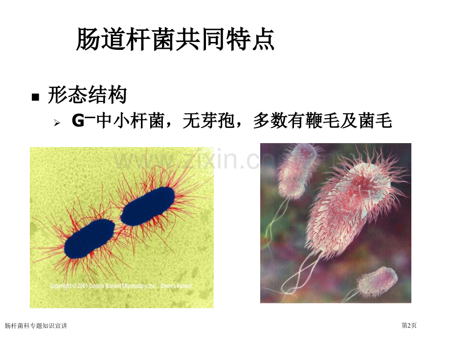 肠杆菌科专题知识宣讲专家讲座.pptx_第2页