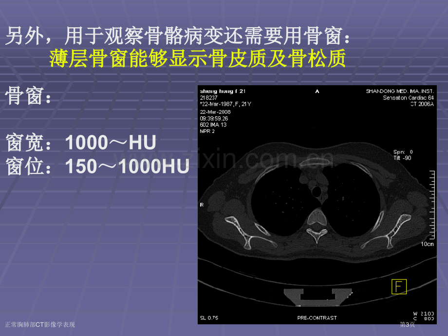 正常胸肺部CT影像学表现专家讲座.pptx_第3页