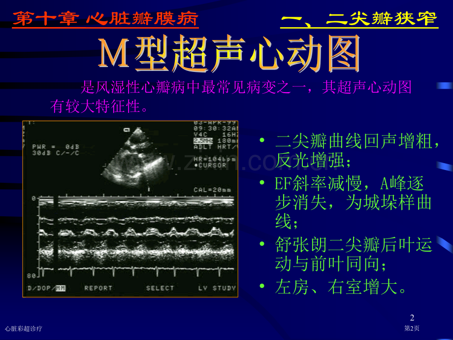 心脏彩超诊疗专家讲座.pptx_第2页