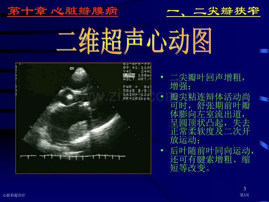 心脏彩超诊疗专家讲座.pptx_第3页