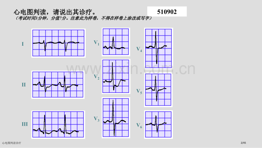 心电图判读诊疗.pptx_第2页