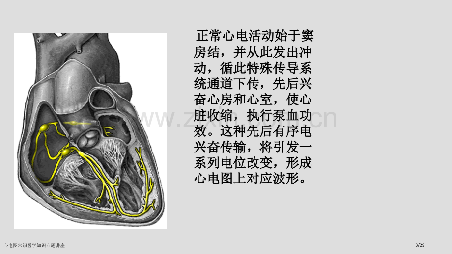 心电图常识医学知识专题讲座.pptx_第3页