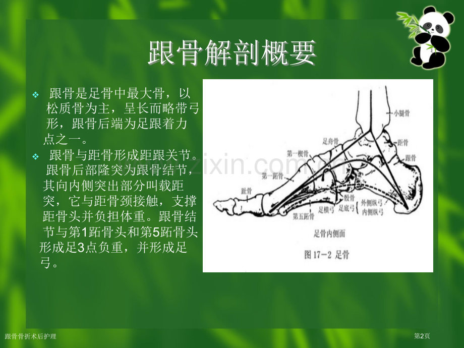 跟骨骨折术后护理.pptx_第2页