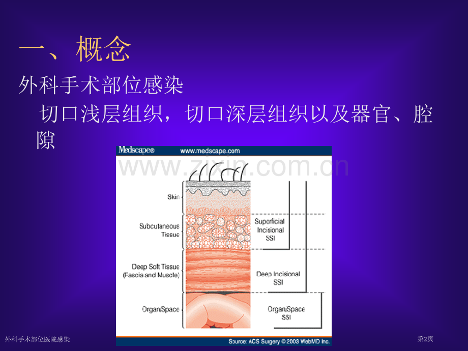 外科手术部位医院感染专家讲座.pptx_第2页