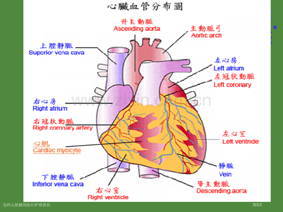 急性心肌梗死医疗护理查房.pptx_第3页