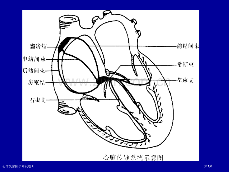 心律失常医学知识培训专家讲座.pptx_第3页