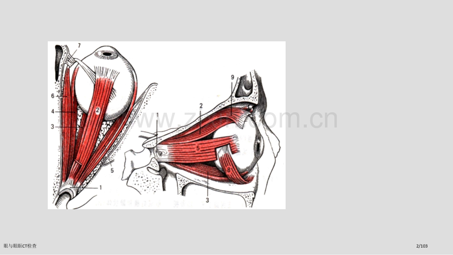 眼与眼眶CT检查.pptx_第2页