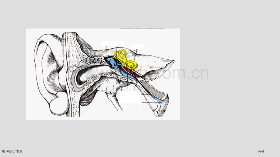 眼与眼眶CT检查.pptx_第3页