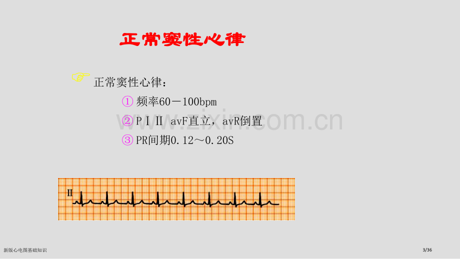 新版心电图基础知识.pptx_第3页