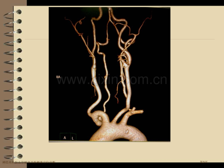 神经内科脑血管解剖及脑梗塞定位诊断.pptx_第3页