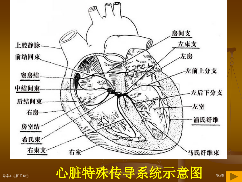 异常心电图的识别专家讲座.pptx_第2页