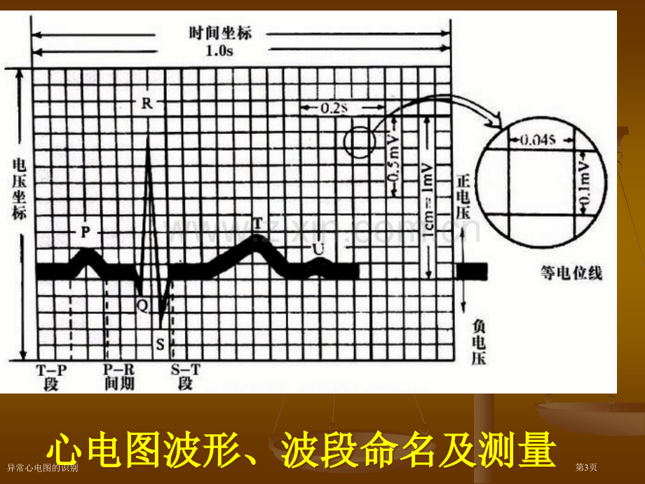 异常心电图的识别专家讲座.pptx_第3页