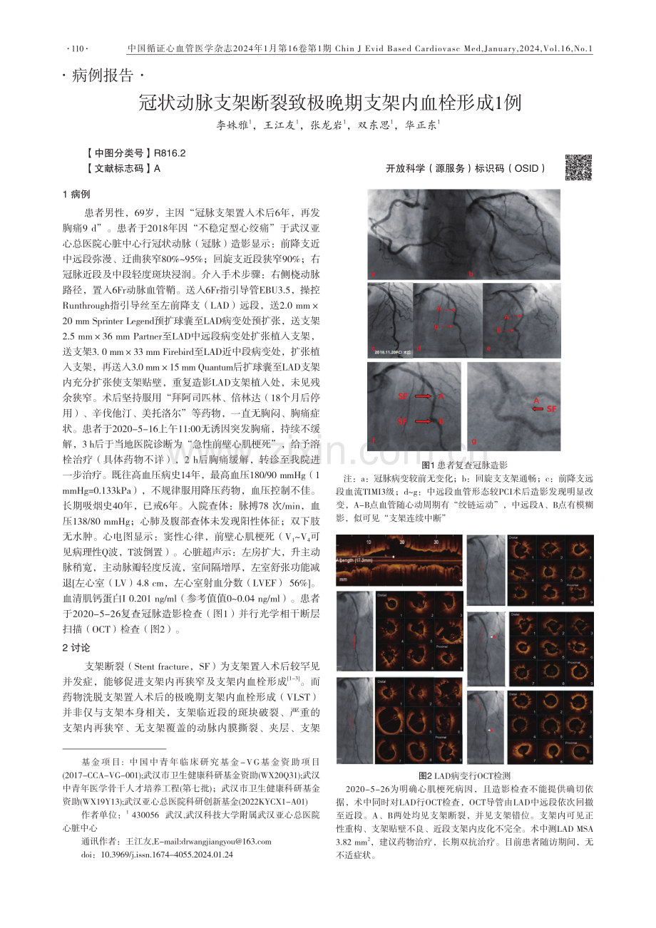 冠状动脉支架断裂致极晚期支架内血栓形成1例.pdf_第1页