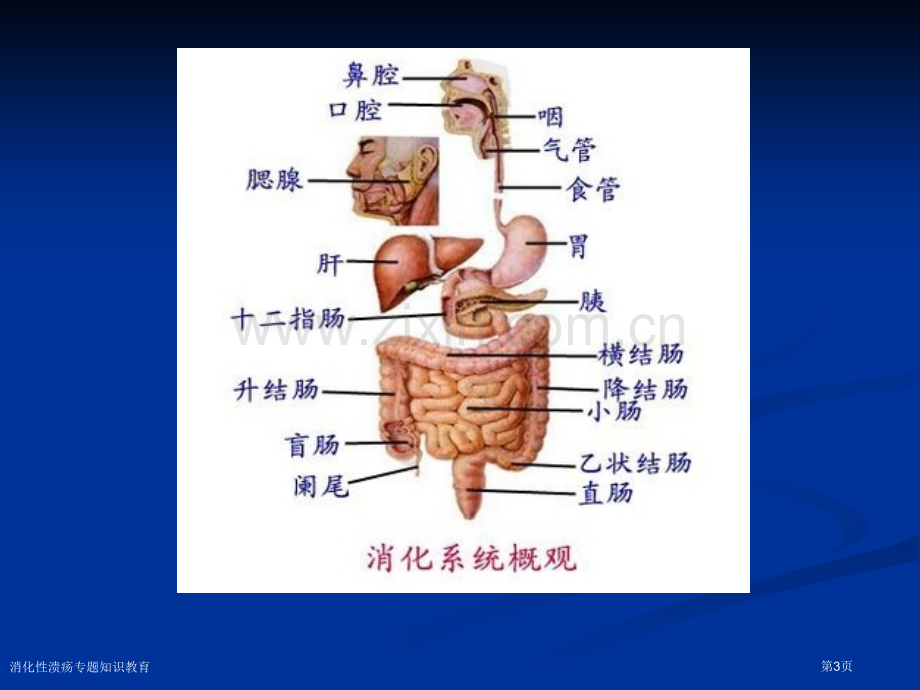 消化性溃疡专题知识教育专家讲座.pptx_第3页