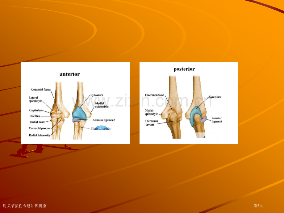 肘关节损伤专题知识讲座专家讲座.pptx_第2页