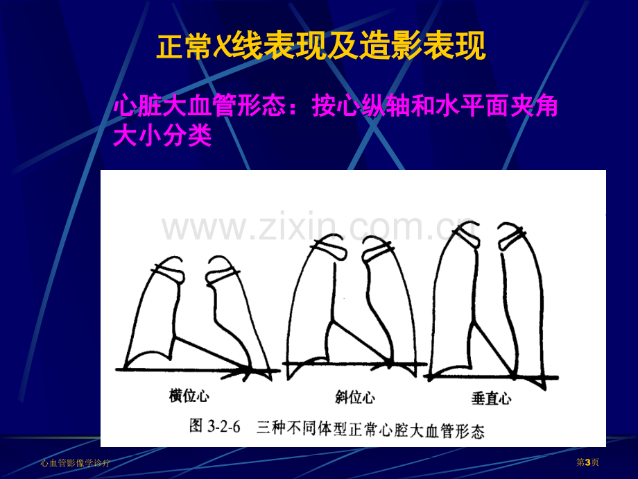 心血管影像学诊疗专家讲座.pptx_第3页