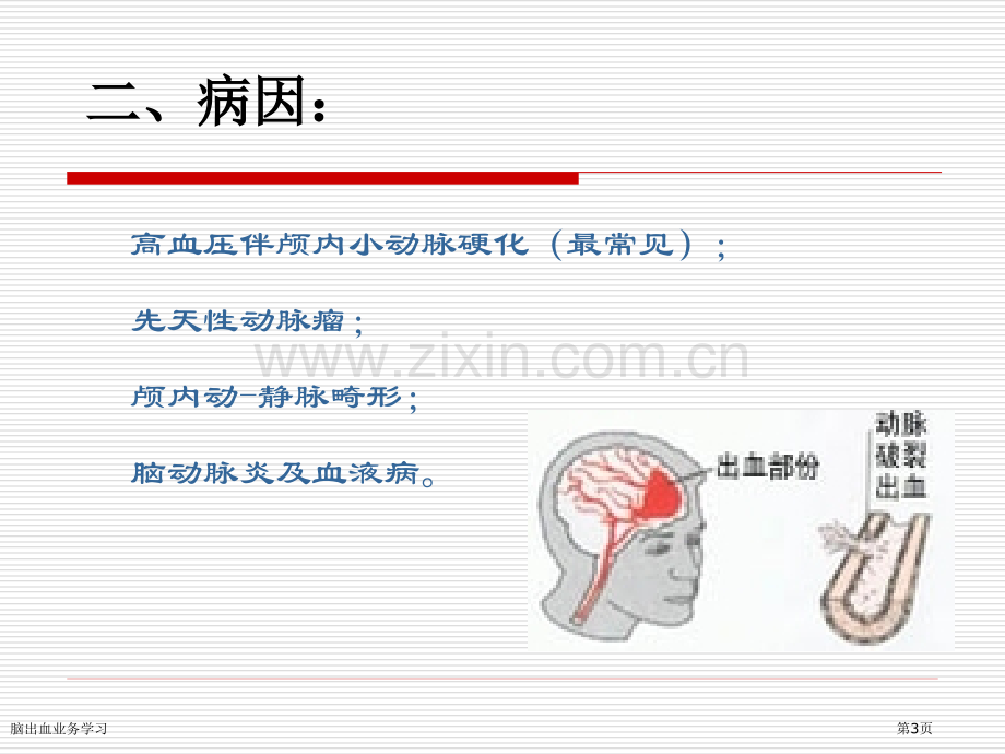 脑出血业务学习.pptx_第3页