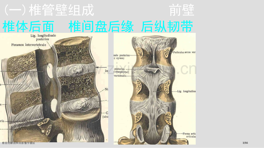 椎管的解剖和其影像学循征.pptx_第3页