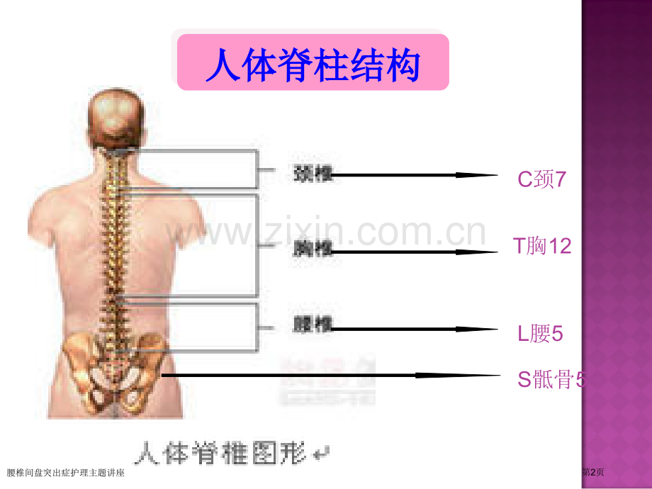 腰椎间盘突出症护理主题讲座.pptx_第2页