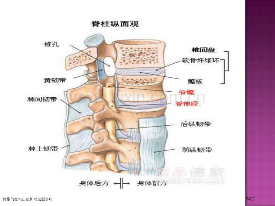 腰椎间盘突出症护理主题讲座.pptx_第3页