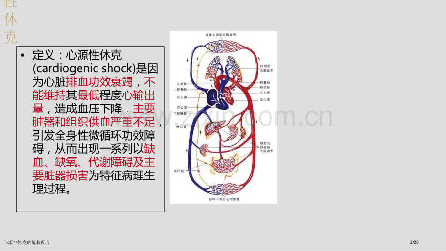 心源性休克的抢救配合.pptx_第2页