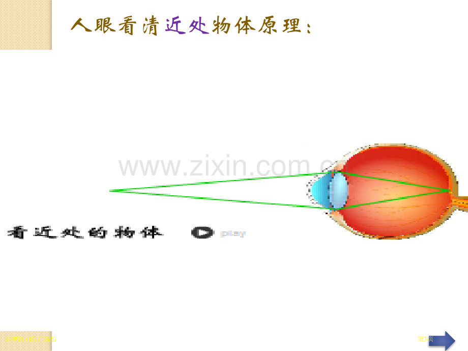 近视眼的防治新版.pptx_第3页