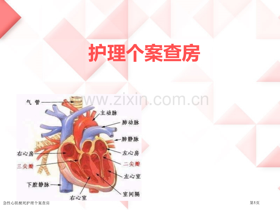 急性心肌梗死护理个案查房专家讲座.pptx_第1页