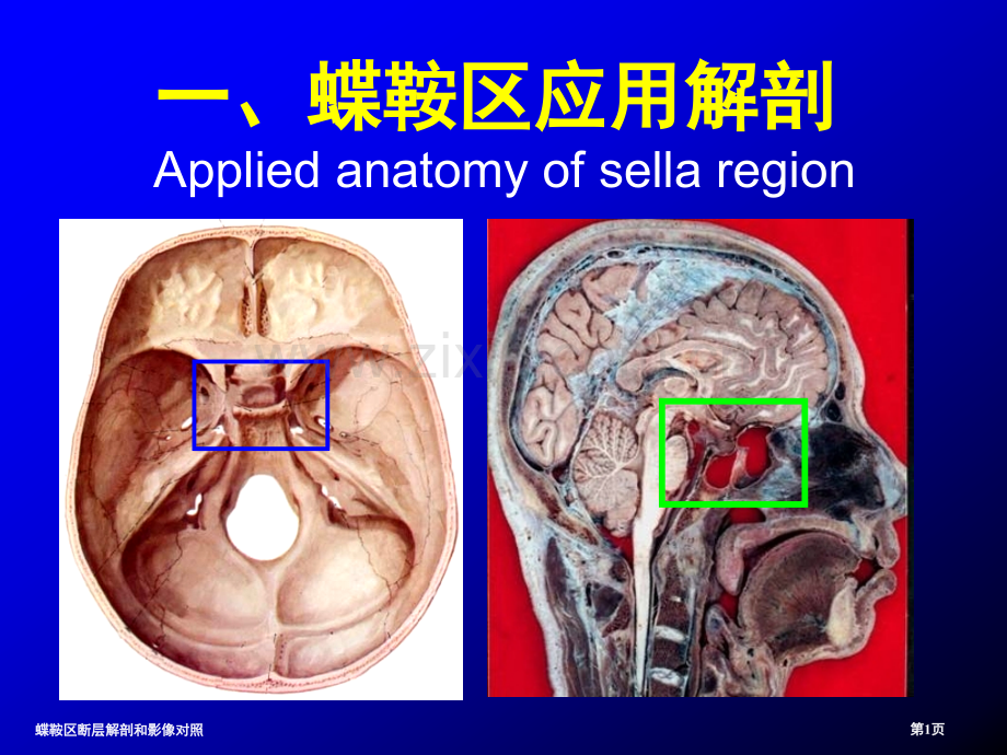 蝶鞍区断层解剖和影像对照.pptx_第1页