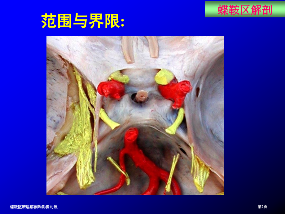 蝶鞍区断层解剖和影像对照.pptx_第2页