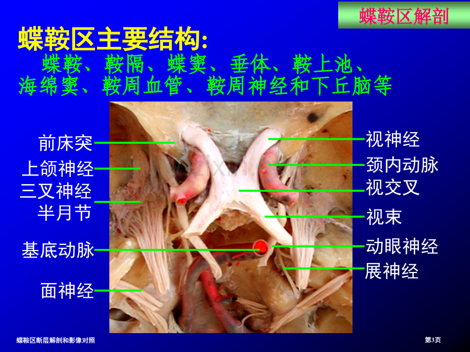 蝶鞍区断层解剖和影像对照.pptx_第3页