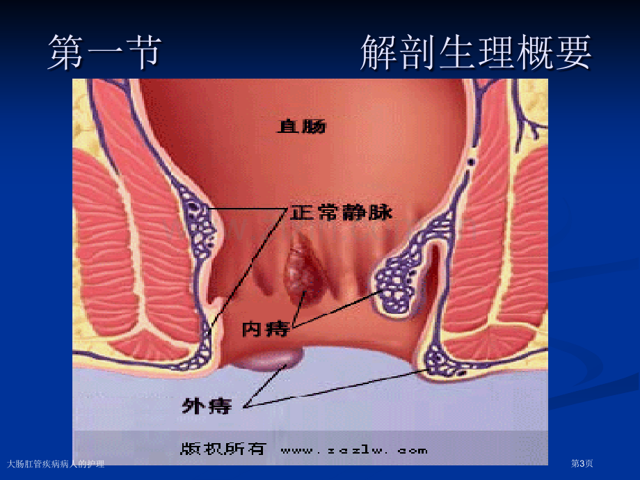 大肠肛管疾病病人的护理专家讲座.pptx_第3页