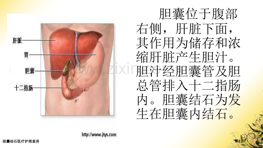 胆囊结石医疗护理查房.pptx_第2页