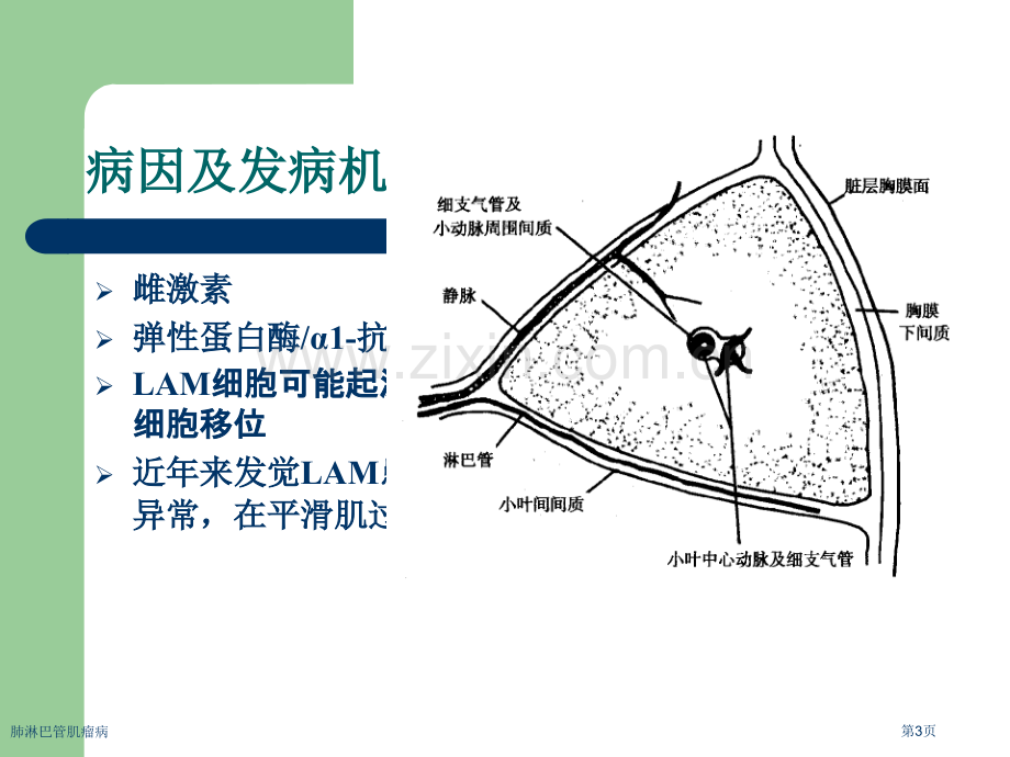 肺淋巴管肌瘤病专家讲座.pptx_第3页