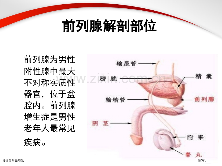 良性前列腺增生.pptx_第3页