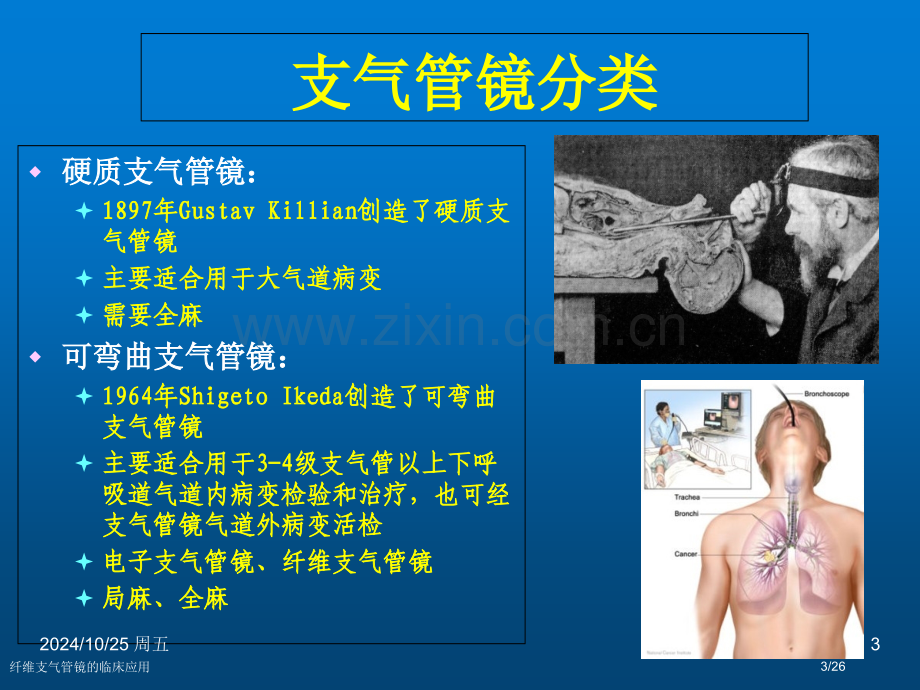 纤维支气管镜的临床应用.pptx_第3页