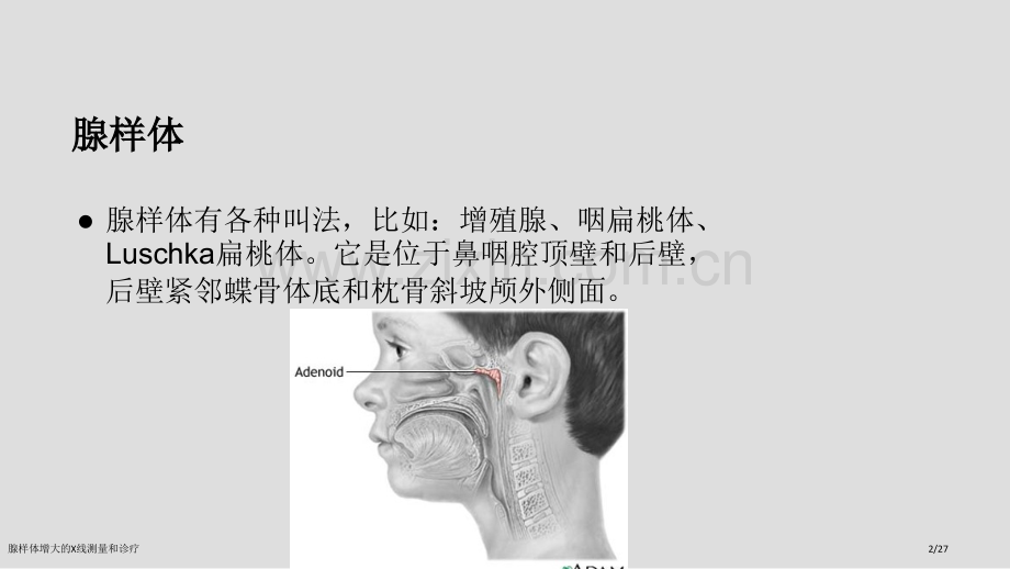 腺样体增大的X线测量和诊疗.pptx_第2页