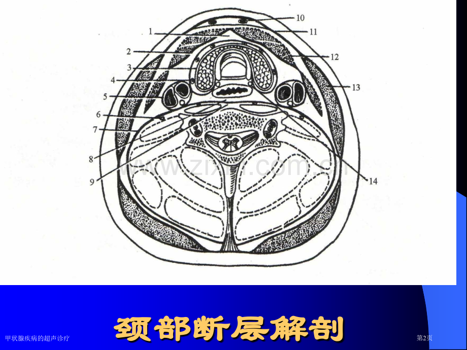 甲状腺疾病的超声诊疗.pptx_第2页