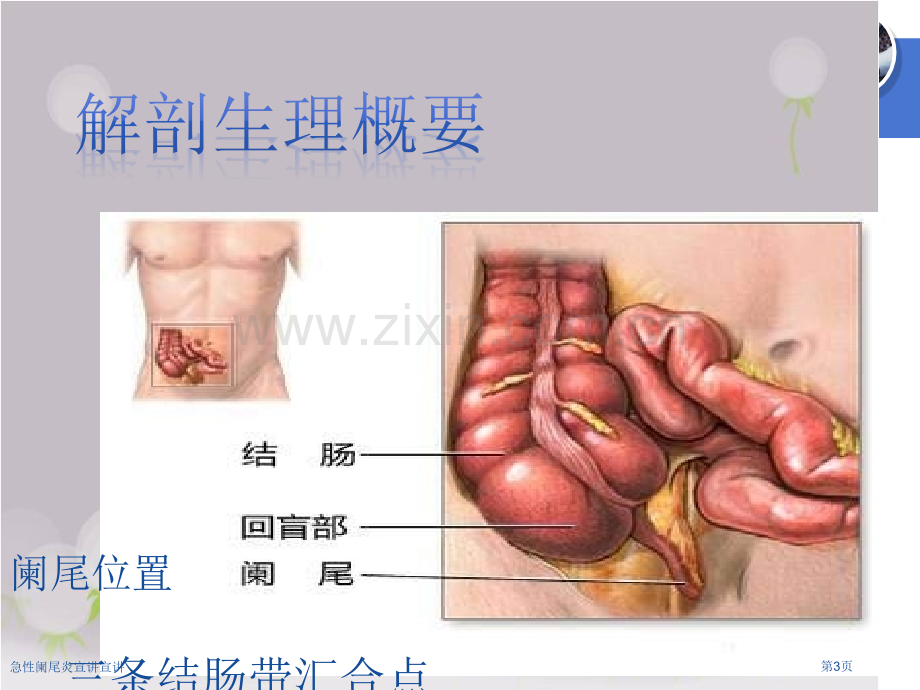 急性阑尾炎宣讲宣讲.pptx_第3页