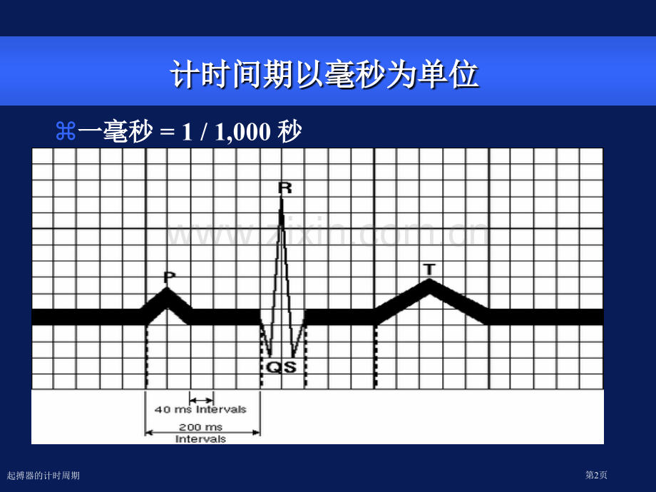 起搏器的计时周期专家讲座.pptx_第2页