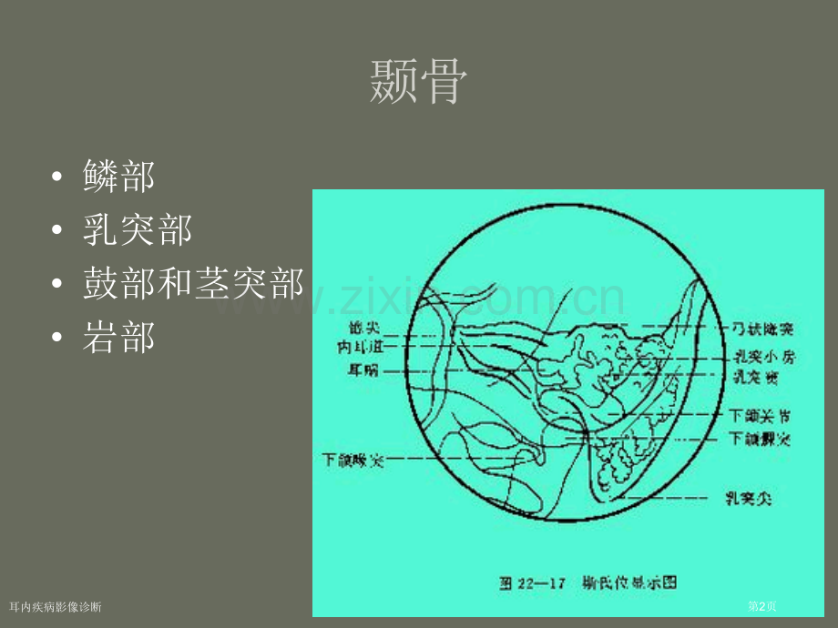 耳内疾病影像诊断.pptx_第2页